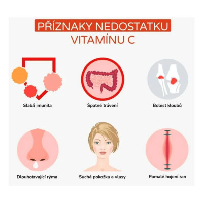BrainMax Organic Vitamin C BIO Acerola, vitamín C z Aceroly, 60 rostlinných kapslí